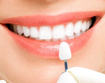 Woman-chosing-white-teeth